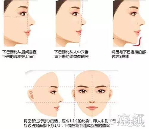 https://img.miyanlife.com/mnt/timg/180914/11144220Q-1.jpg