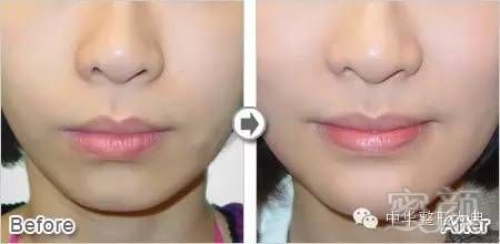https://img.miyanlife.com/mnt/timg/180914/1114422V6-4.jpg