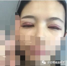 https://img.miyanlife.com/mnt/timg/180914/112055E19-2.jpg