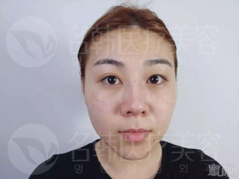 https://img.miyanlife.com/mnt/timg/180914/12062KK8-0.jpg