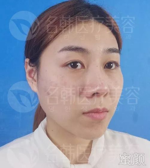 https://img.miyanlife.com/mnt/timg/180914/120630GA-11.jpg