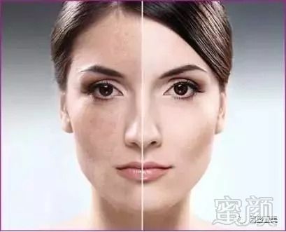 https://img.miyanlife.com/mnt/timg/180914/1219431361-4.jpg