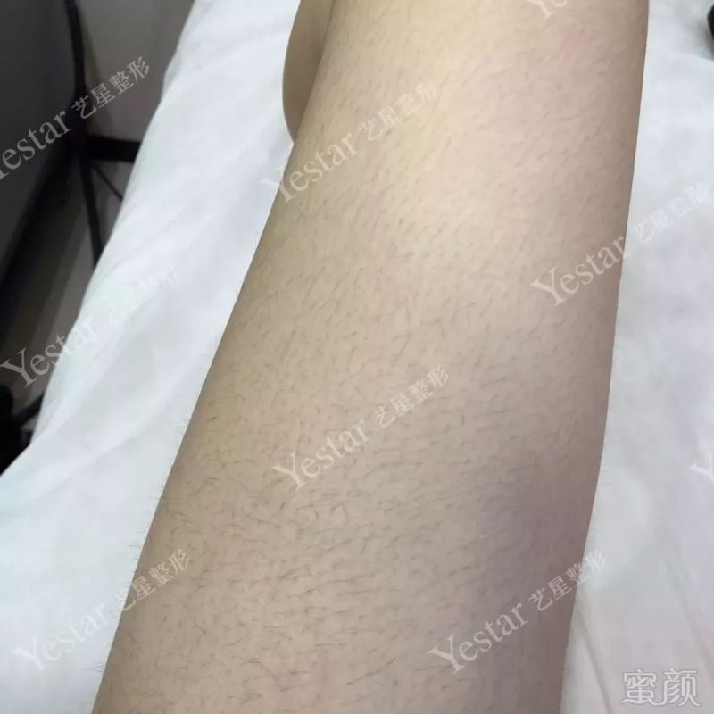 https://img.miyanlife.com/mnt/timg/180914/121G91237-9.jpg