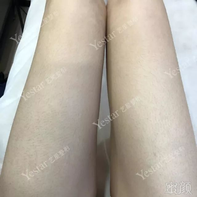 https://img.miyanlife.com/mnt/timg/180914/121G93R8-7.jpg