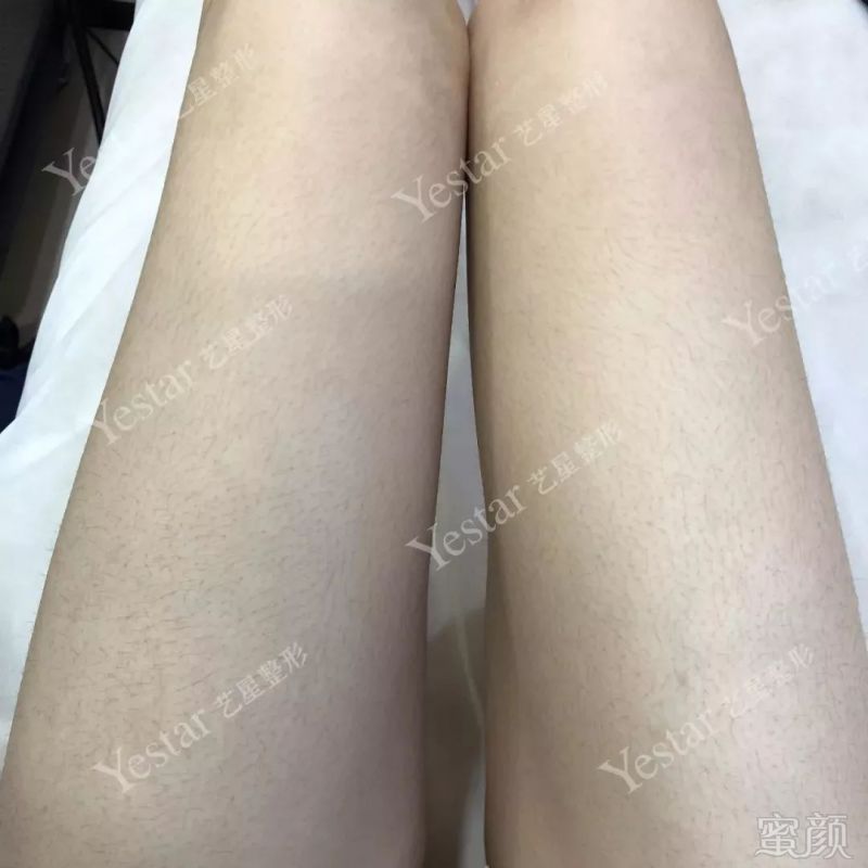 https://img.miyanlife.com/mnt/timg/180914/121GLP5-4.jpg