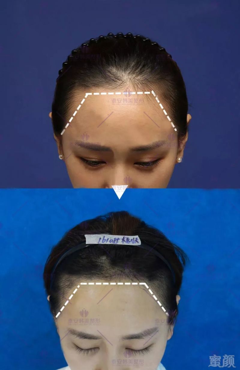 https://img.miyanlife.com/mnt/timg/180914/122014F25-7.jpg
