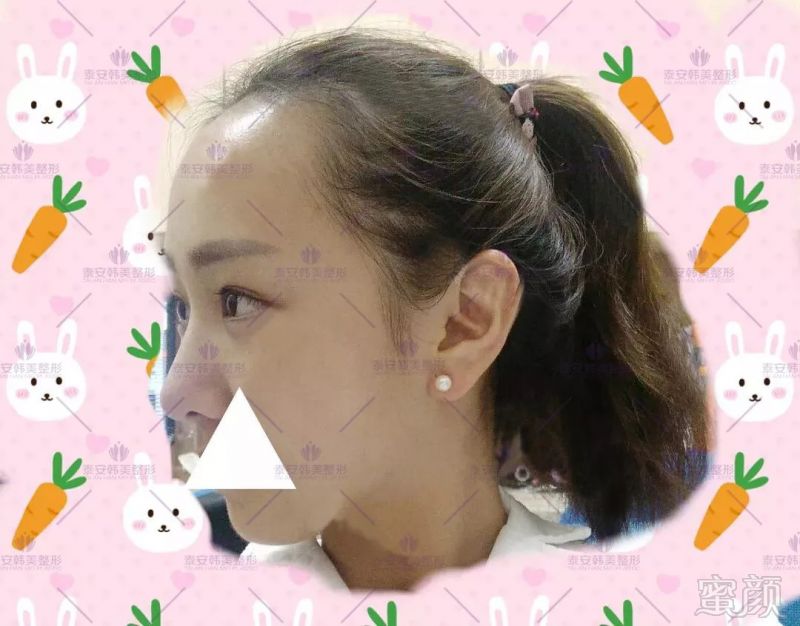 https://img.miyanlife.com/mnt/timg/180914/122014Jb-5.jpg