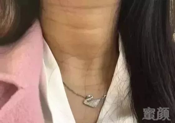 https://img.miyanlife.com/mnt/timg/180914/12322GZ1-1.jpg