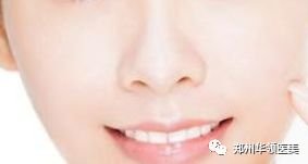 https://img.miyanlife.com/mnt/timg/180914/12392L053-1.jpg