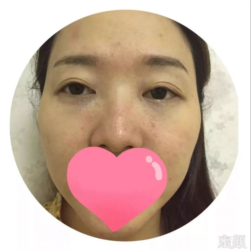 https://img.miyanlife.com/mnt/timg/180914/1240191239-0.jpg