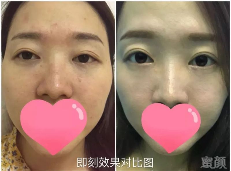 https://img.miyanlife.com/mnt/timg/180914/1240203444-3.jpg