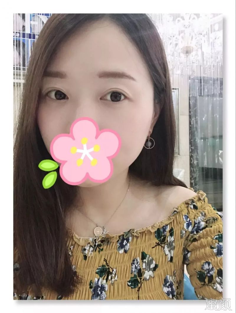 https://img.miyanlife.com/mnt/timg/180914/124021DY-4.jpg