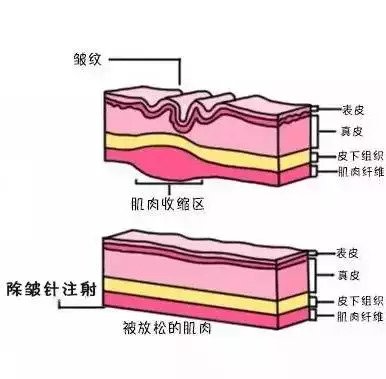 https://img.miyanlife.com/mnt/timg/180914/1246092R1-6.jpg
