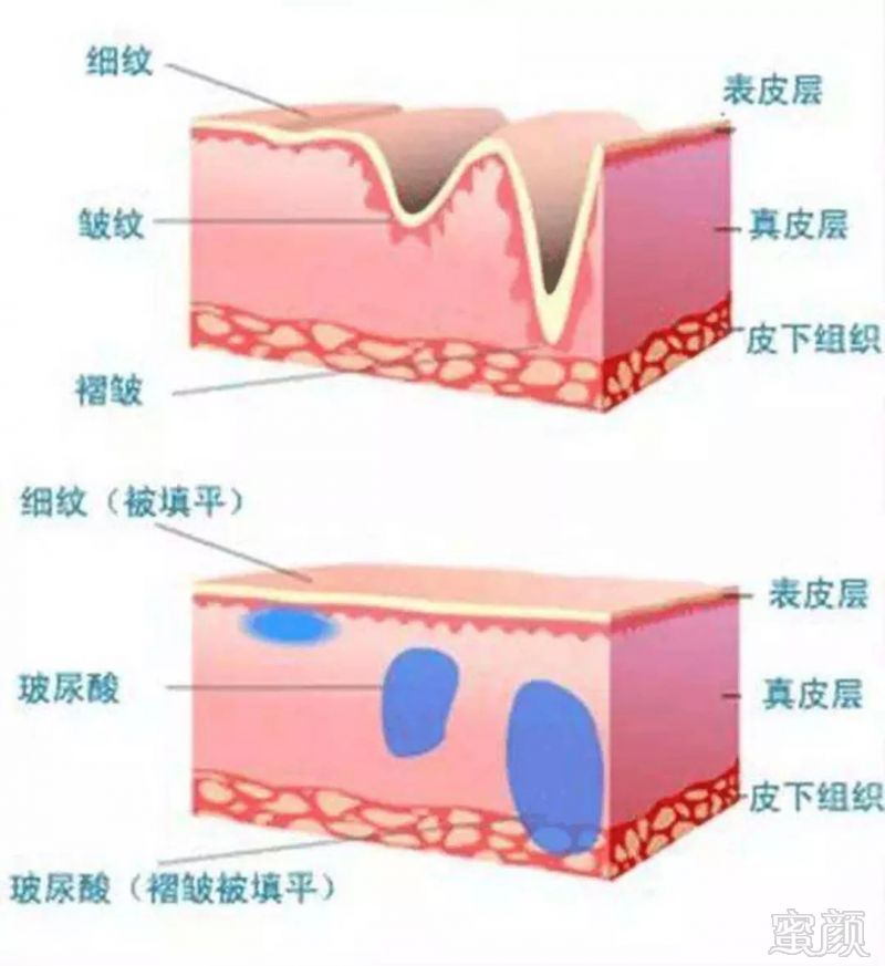 https://img.miyanlife.com/mnt/timg/180914/12460V546-4.jpg