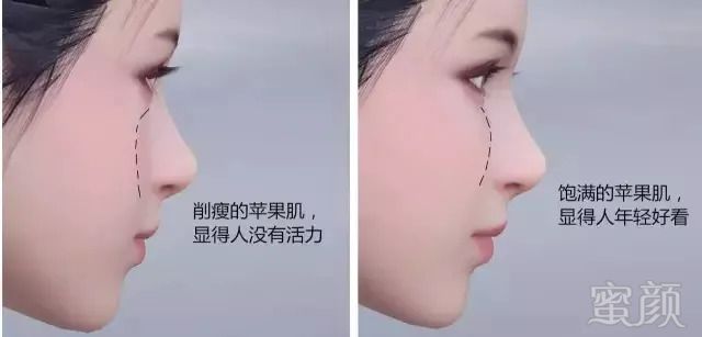 https://img.miyanlife.com/mnt/timg/180914/124P63V3-4.jpg