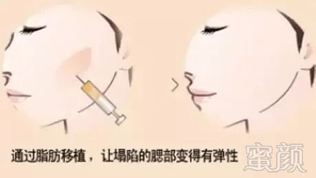 https://img.miyanlife.com/mnt/timg/180914/124PL204-8.jpg