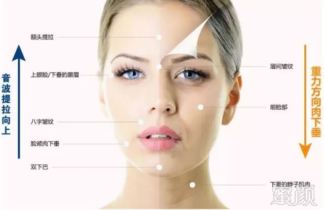 https://img.miyanlife.com/mnt/timg/180914/1309212b2-1.jpg