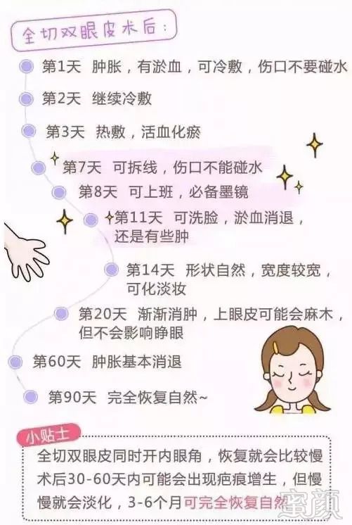 https://img.miyanlife.com/mnt/timg/180914/130QQ324-0.jpg