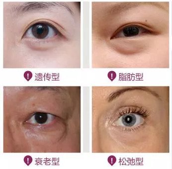 https://img.miyanlife.com/mnt/timg/180914/1310135924-1.jpg