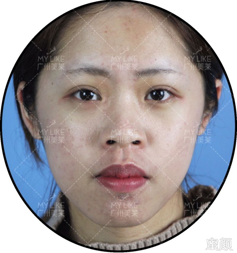 https://img.miyanlife.com/mnt/timg/180915/095614B91-0.jpg