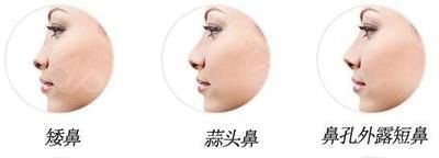 https://img.miyanlife.com/mnt/timg/180915/0956162138-4.jpg