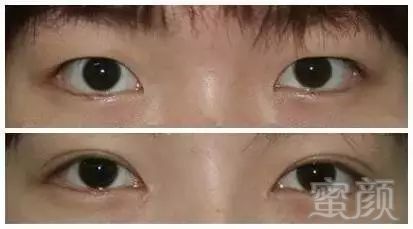 https://img.miyanlife.com/mnt/timg/180915/103639D23-2.jpg