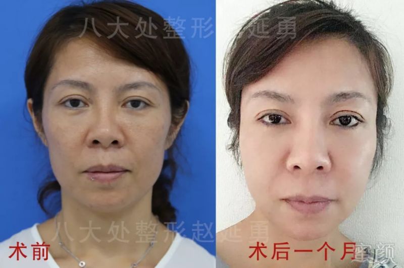 https://img.miyanlife.com/mnt/timg/180915/1045013639-4.jpg