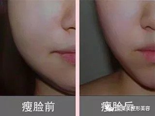 https://img.miyanlife.com/mnt/timg/180915/1055123101-4.jpg