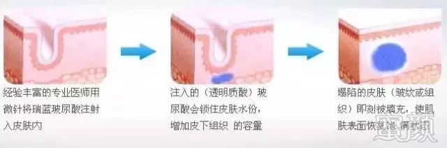 案例图片