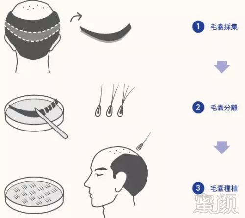 https://img.miyanlife.com/mnt/timg/180915/1101493511-1.jpg