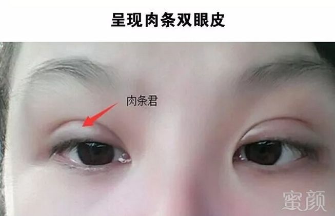 https://img.miyanlife.com/mnt/timg/180915/1110461612-7.jpg