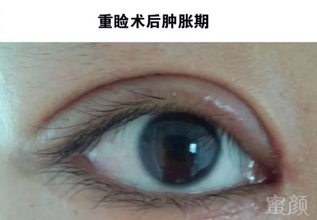 https://img.miyanlife.com/mnt/timg/180915/11104B9B-10.jpg