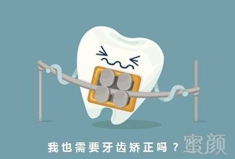 https://img.miyanlife.com/mnt/timg/180915/11111U239-4.jpg