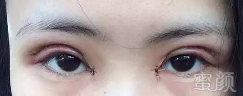 https://img.miyanlife.com/mnt/timg/180915/1113542c6-2.jpg
