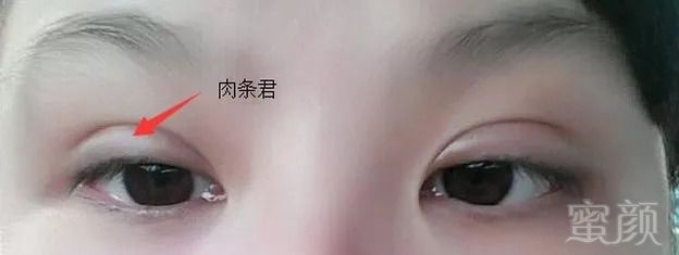https://img.miyanlife.com/mnt/timg/180915/1116191027-10.jpg