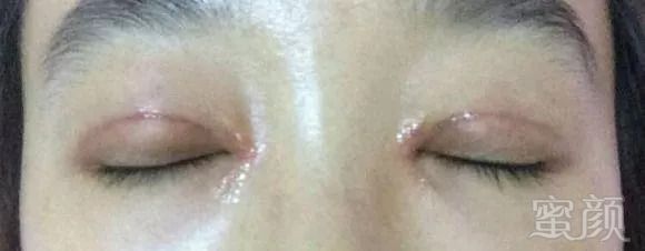 https://img.miyanlife.com/mnt/timg/180915/1116192U2-15.jpg