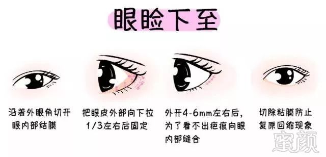https://img.miyanlife.com/mnt/timg/180915/11161WZ0-5.jpg