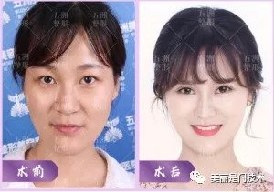https://img.miyanlife.com/mnt/timg/180915/11201JX1-1.jpg