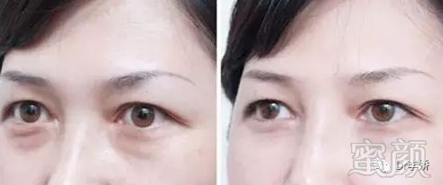 https://img.miyanlife.com/mnt/timg/180915/11221GF7-7.jpg