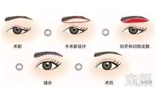 https://img.miyanlife.com/mnt/timg/180915/11221MU0-8.jpg