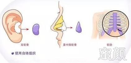 https://img.miyanlife.com/mnt/timg/180915/11453B2a-6.jpg
