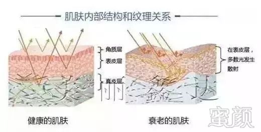 https://img.miyanlife.com/mnt/timg/180915/114R31U5-2.jpg
