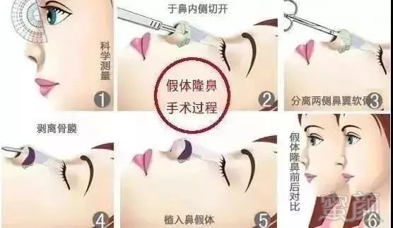 https://img.miyanlife.com/mnt/timg/180915/114R421Y-3.jpg