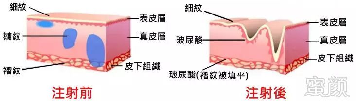 案例图片