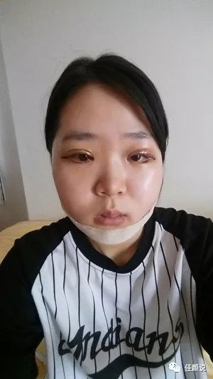 https://img.miyanlife.com/mnt/timg/180915/115P54091-7.jpg