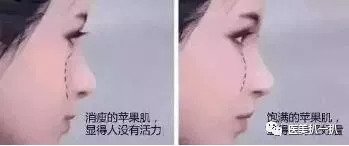 https://img.miyanlife.com/mnt/timg/180915/115Z02496-1.jpg