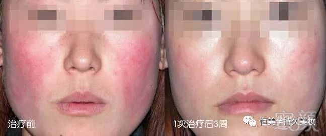 https://img.miyanlife.com/mnt/timg/180916/122R41425-4.jpg