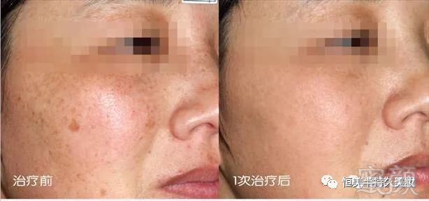 https://img.miyanlife.com/mnt/timg/180916/122R43420-6.jpg