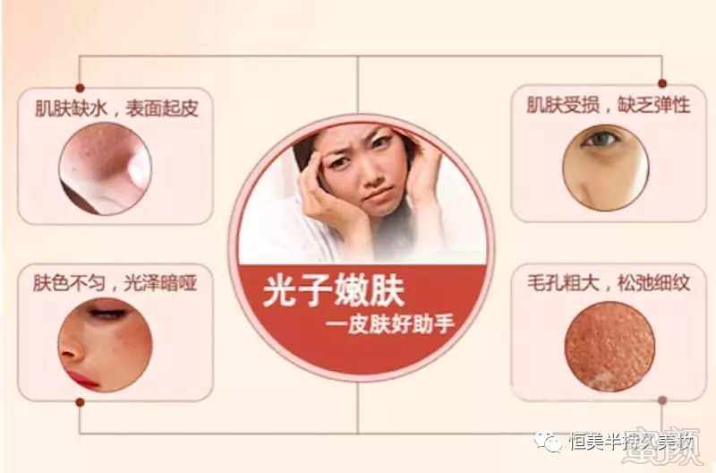 https://img.miyanlife.com/mnt/timg/180916/122R44155-2.jpg