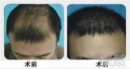 https://img.miyanlife.com/mnt/timg/180916/12350U5P-6.jpg
